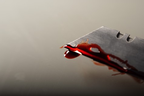 Dương vật rất quan trọng đối với nam giới, hãy cẩn thận trong việc xử lý vùng kín