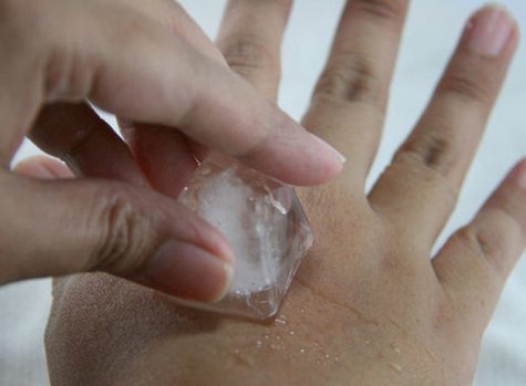 Dùng đá lạnh chườm vào tay có thể giảm đau răng 