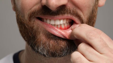 Các phương pháp cải thiện nhiệt miệng hiệu quả