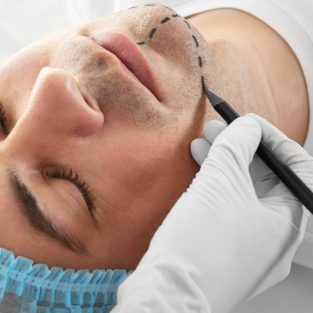 Nam giới thật sự nghĩ gì về phẫu thuật thẩm mỹ?