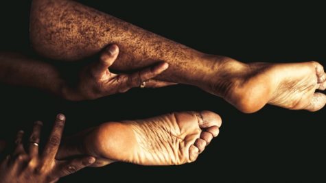 Hôi chân: Đi tìm nguyên nhân và cách khử mùi hiệu quả